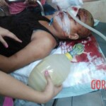 Teen Filipina killed by stray