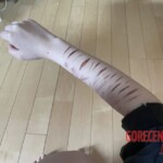 Teen girl self-harm