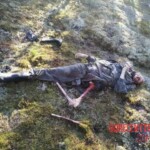 Terrifying aftermath of bear attack