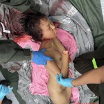 Slashed thai woman
