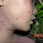 Dead young girl in forest