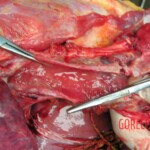 Dead young girl in forest