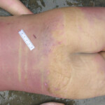 Dead young girl in forest