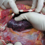 Dead young girl in forest