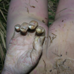 Dead young girl in forest