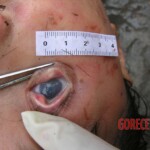 Young girl died in forest, face partially eaten
