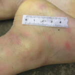 Dead young girl in forest