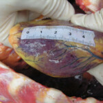 Dead young girl in forest