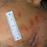 Dead young girl in forest