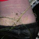 Dead young girl in forest