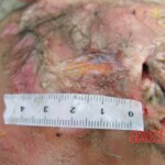 Dead young girl in forest