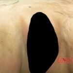 Dead young girl in forest