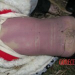 Dead young girl in forest