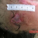 Young girl died in forest, face partially eaten