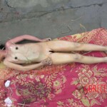 Dead young girl in forest