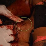 Tácila Oliveira Rodrigues dos Santos