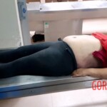 Autopsy of drowned woman