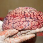 Autopsy of drowned woman