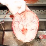 Autopsy of drowned woman