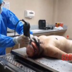 Autopsy of drowned woman