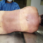 Autopsy of drowned woman