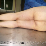 Autopsy of drowned woman