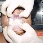 Autopsy of drowned woman