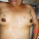 Autopsy of drowned woman