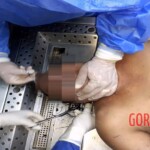 Autopsy of drowned woman