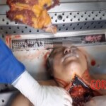 Autopsy of drowned woman