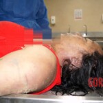 Autopsy of drowned woman