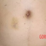 Autopsy of drowned woman