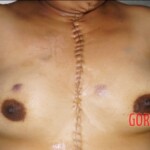 Autopsy of drowned woman