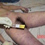 Hanged Chinese woman