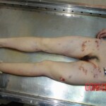 Chinese woman in morgue