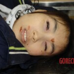 Chinese woman in morgue