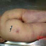 Chinese woman in morgue