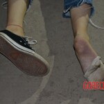 Female suicide jumper