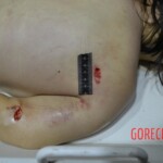 Female suicide jumper