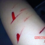 Self-harm on teen girl