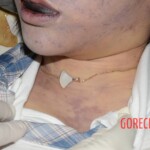 Dead Chinese woman in sexy outfit