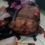 Ex-wife of drug dealer dismembered in suitcase