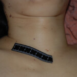 Examination and autopsy of Chinese woman