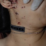 Examination and autopsy of Chinese woman