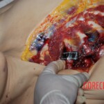 Examination and autopsy of Chinese woman