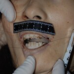 Examination and autopsy of Chinese woman