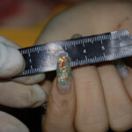 Examination and autopsy of Chinese woman