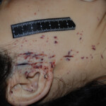 Examination and autopsy of Chinese woman