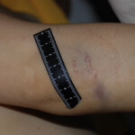 Examination and autopsy of Chinese woman