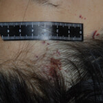 Examination and autopsy of Chinese woman